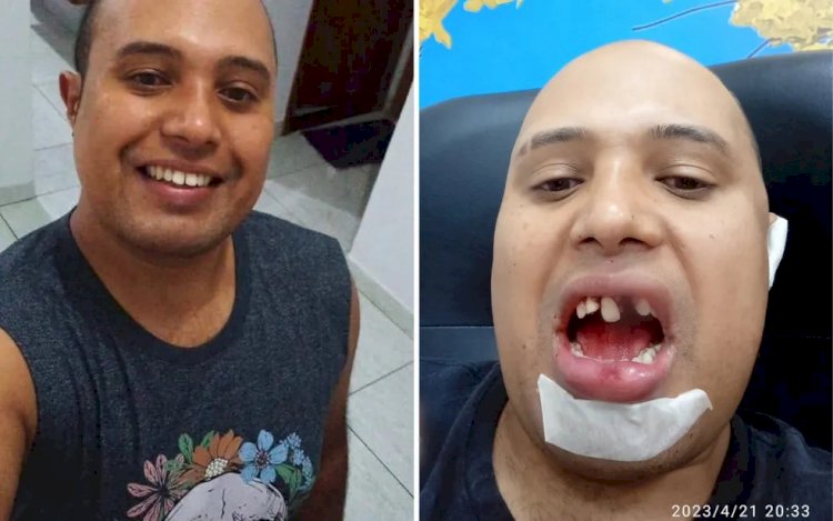 Inquilino que denunciou ter sido vítima de homofobia ao ter dentes quebrados por dono de imóvel diz que está com dificuldade até para comer: 'Abalado e triste'